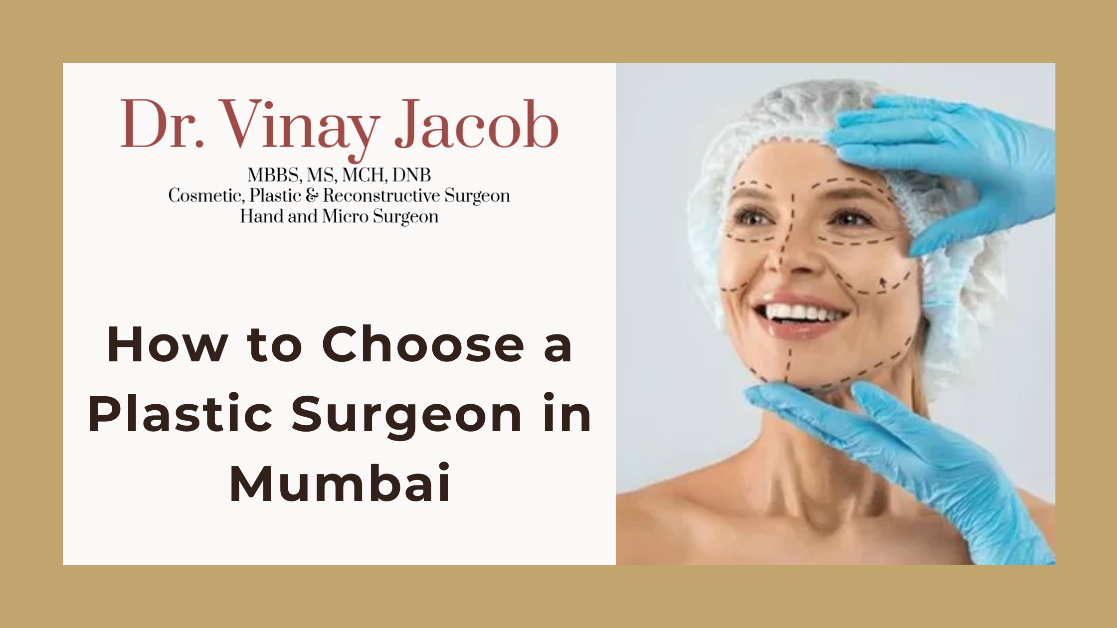 How to Choose a Plastic Surgeon in Mumbai: A Complete Patient Guide